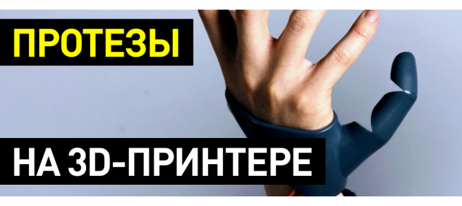 Протез стопы на 3д принтере. Пройти путь от идеи до прототипа