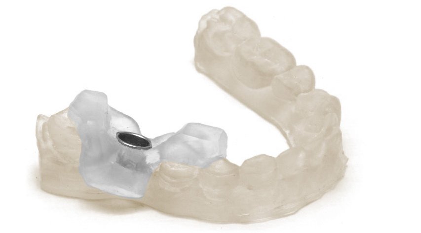 Пример печати из Фотополимер Harz Labs Dental SLA/Form 2 1кг Clear (просроченный)