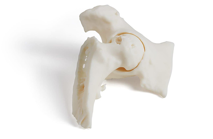 Головка бедренной кости и вертлужная впадина изготовлена на 3D принтере Formlabs Form 3B+