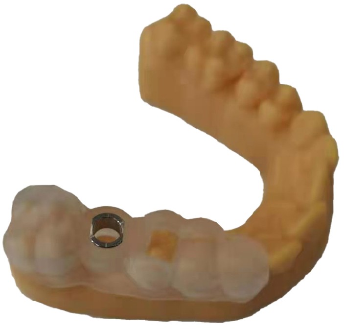 Макет, стоматология, сделано на 3D принтер FlashForge Focus 8.9 