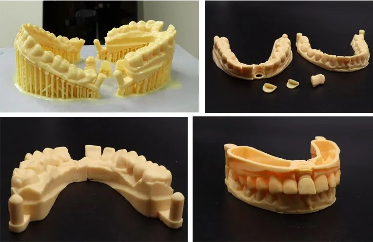 Изделия для стоматологии выполненные на 3D принтере Uniz SLASH 2 Plus