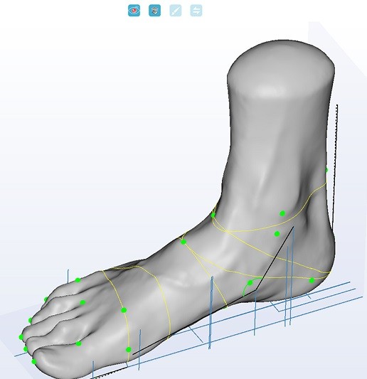 Пример скана ортопедического 3D сканера UPOD-HD