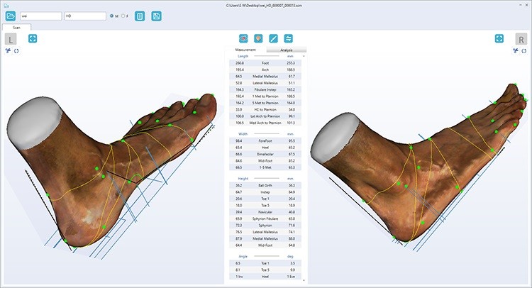 Пример сканирования ортопедического 3D сканера UPOD-HD