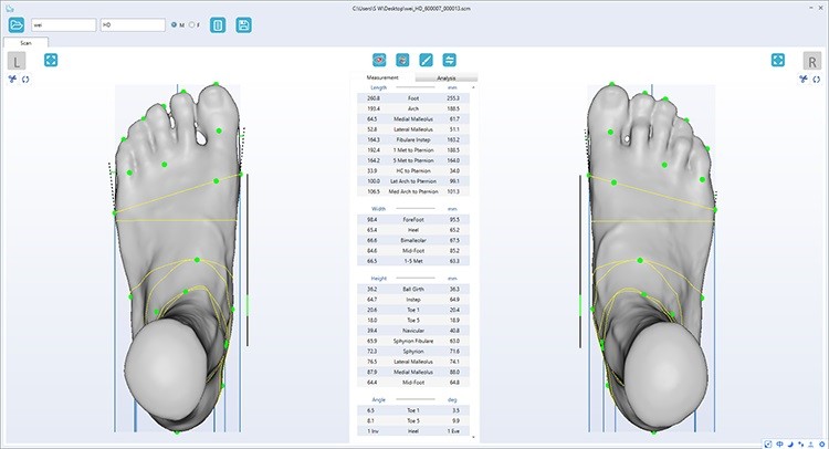 Образец сканирования ортопедического 3D сканера UPOD-HD