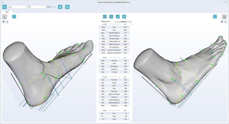 Измерения при сканировании ортопедическим 3D сканером UPOD-HD
