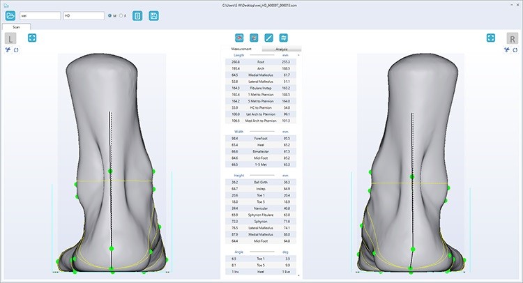 Качество сканирования ортопедического 3D сканера UPOD-HD