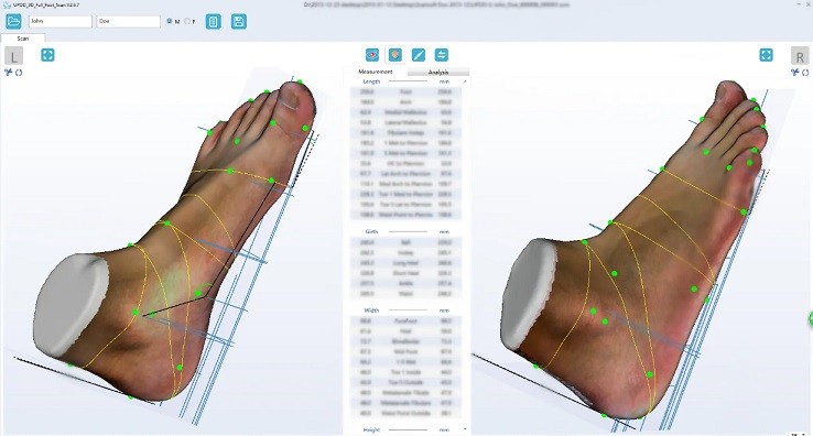 Качество картинки скана ортопедического 3D сканера UPOD-S
