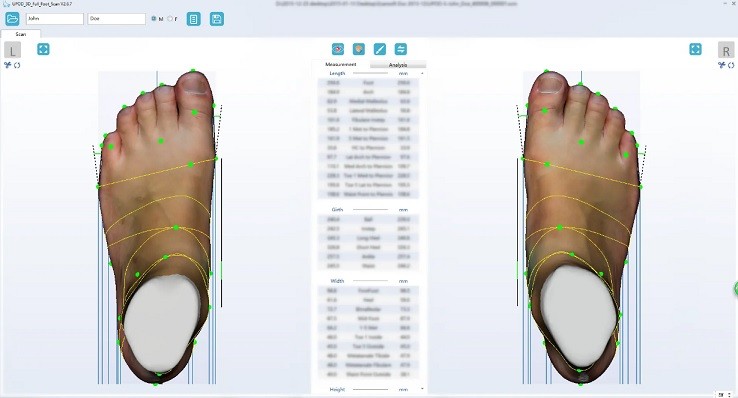 Образец скана ортопедического 3D сканера UPOD-S