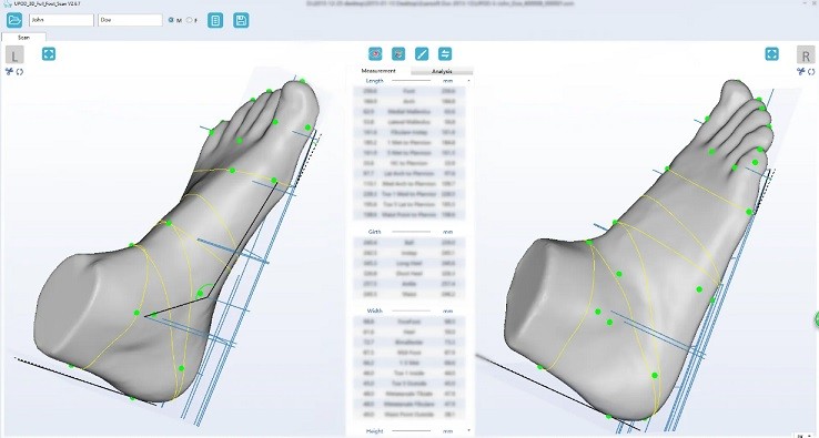 Измерения при сканировании ортопедическим 3D сканером UPOD-S