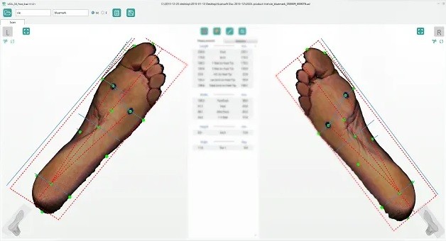 Сканы полученные ортопедическим 3D сканером USOL-DUO
