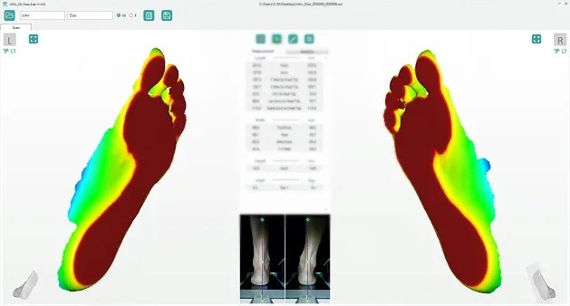 Результаты сканирования ортопедического 3D сканера USOL-DUO