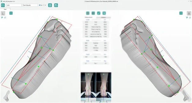 Диагностика стопы выполненная ортопедическим 3D сканером USOL-DUO